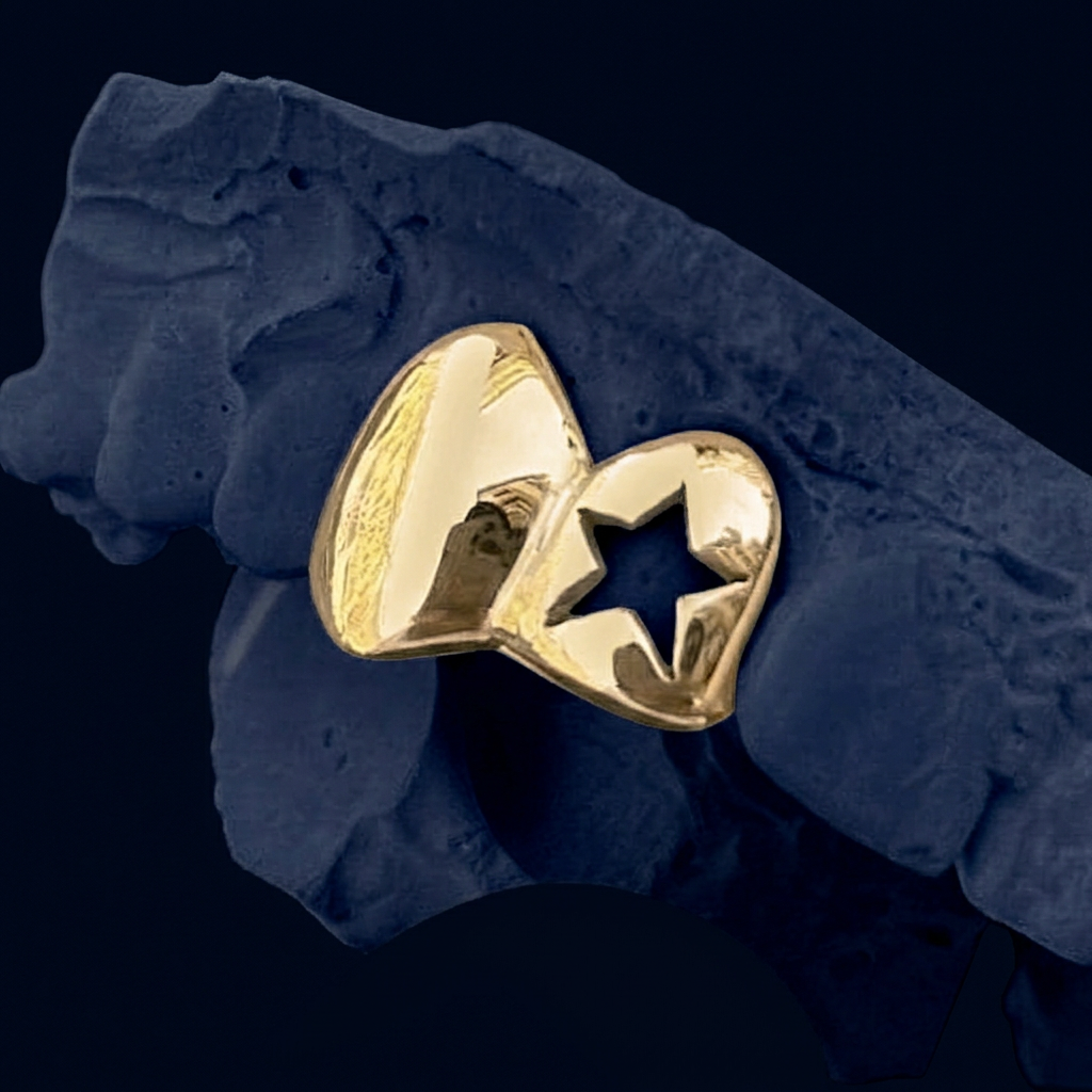 Starlight - Gold Two Teeth Star Grillz - yellow gold - custom fit grillz handmade by Icestein Jewelers