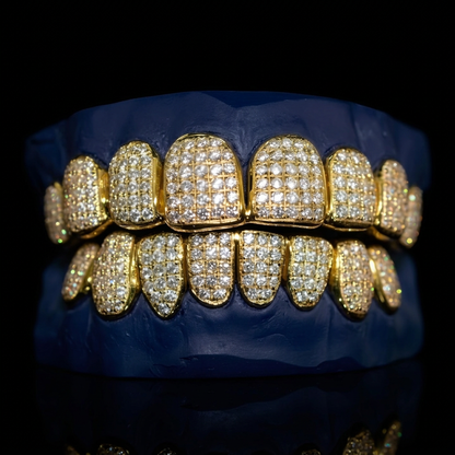 Royal Drop - Gold VS Diamond Grillz