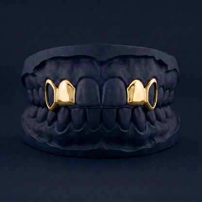Split Level - Gold Four Teeth Open Face Grillz - yellow gold - custom fit grillz handmade by Icestein Jewelers