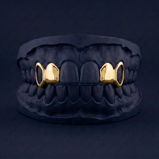 Split Level - Gold Four Teeth Open Face Grillz - yellow gold - custom fit grillz handmade by Icestein Jewelers