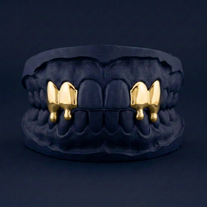 Meltdown Four - Gold Four Teeth Drip Grillz - yellow gold - custom fit grillz handmade by Icestein Jewelers