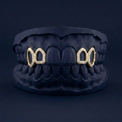 Frozen Frame - Silver Iced Out Open Face Grillz - gold plated - custom fit grillz handmade by Icestein Jewelers