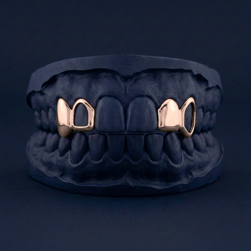 Checkerboard - Gold Alternating Open Face Grillz - alternating layout, also available on this listing