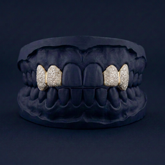 Gold Four Teeth Diamond Dust