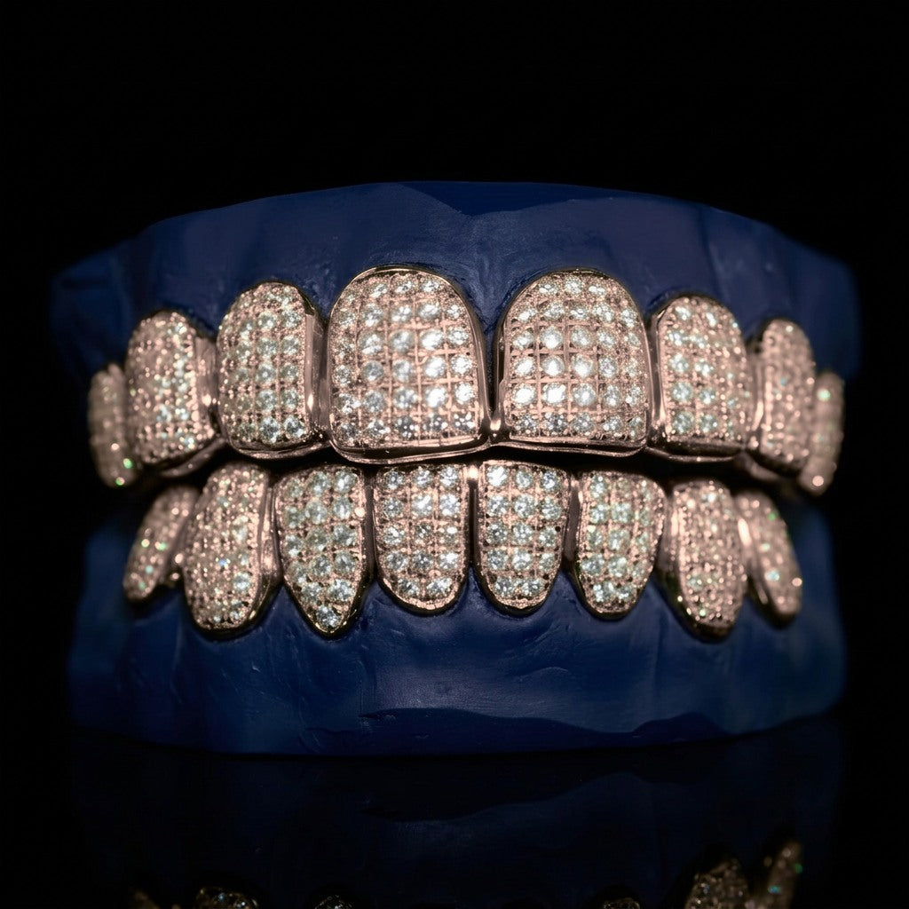 Royal Drop - Gold VS Diamond Grillz