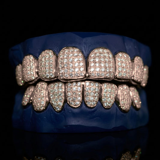 Royal Drop - Gold VS Diamond Grillz